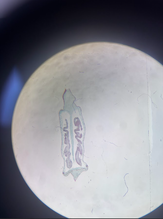 <ul><li><p><span><strong>Diploid tissue</strong> (the capsule itself)</span></p></li><li><p><span>Inside: <strong>spore mother cells</strong> undergo meiosis → haploid spores</span></p></li><li><p><span>The capsule walls and stalk are diploid sporophyte tissue</span></p></li></ul><p></p>