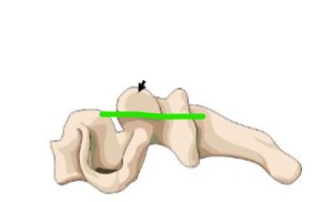 <p>Horizontal</p>