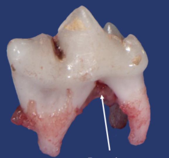 <p>What is shown in this image?</p>