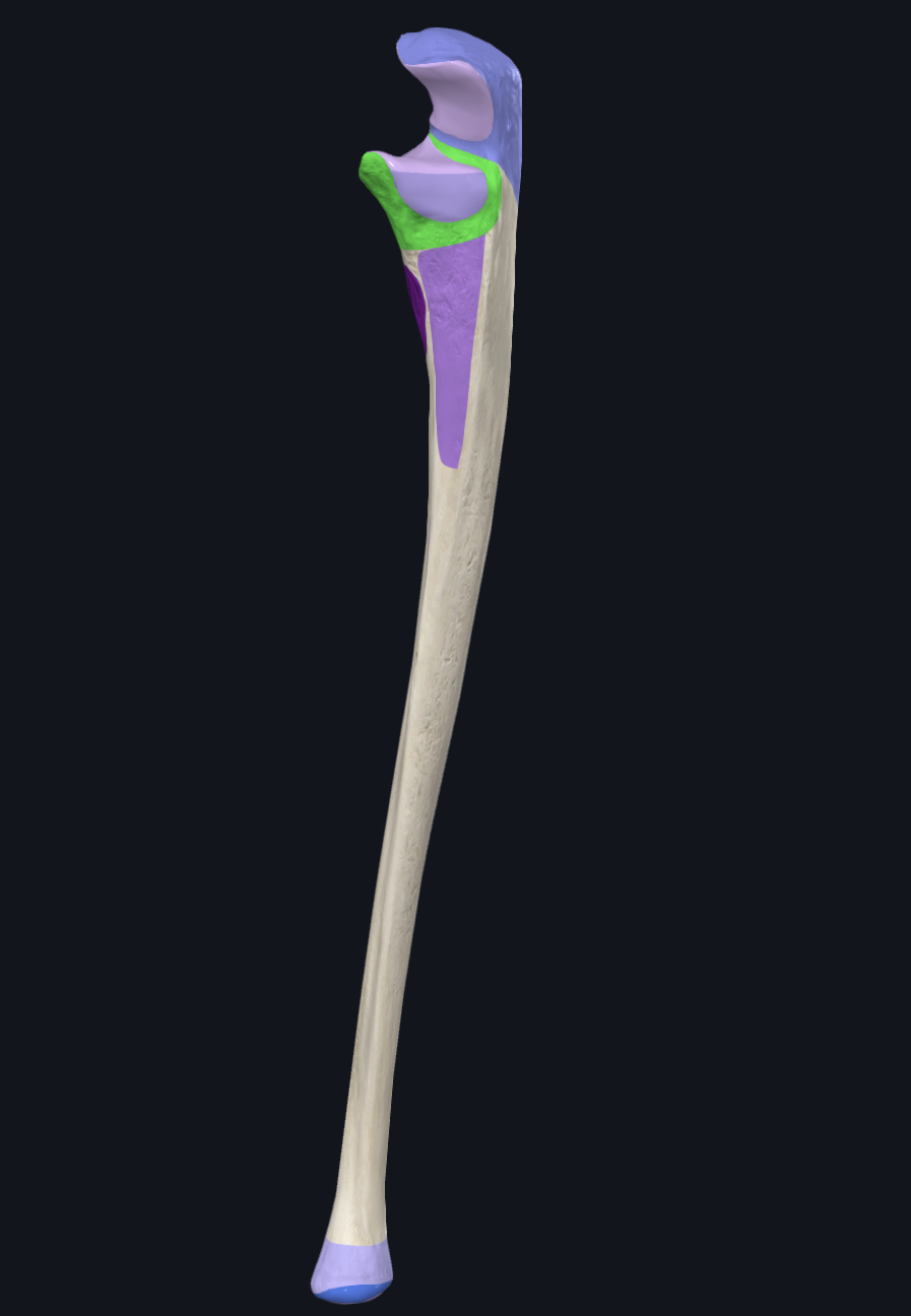 <p>What is highlighted in green?</p>
