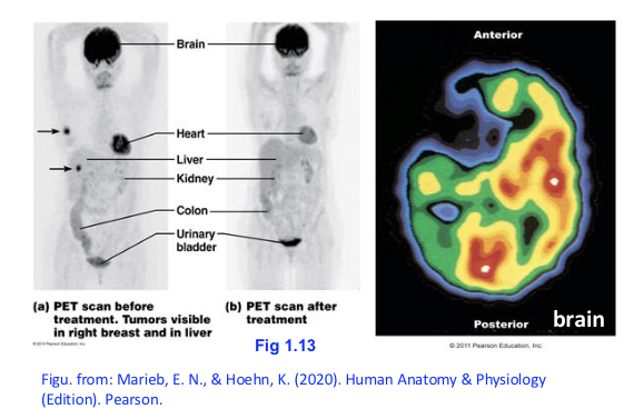 <p>Describe <span>Positron emission tomography <strong>(PET).</strong></span></p>