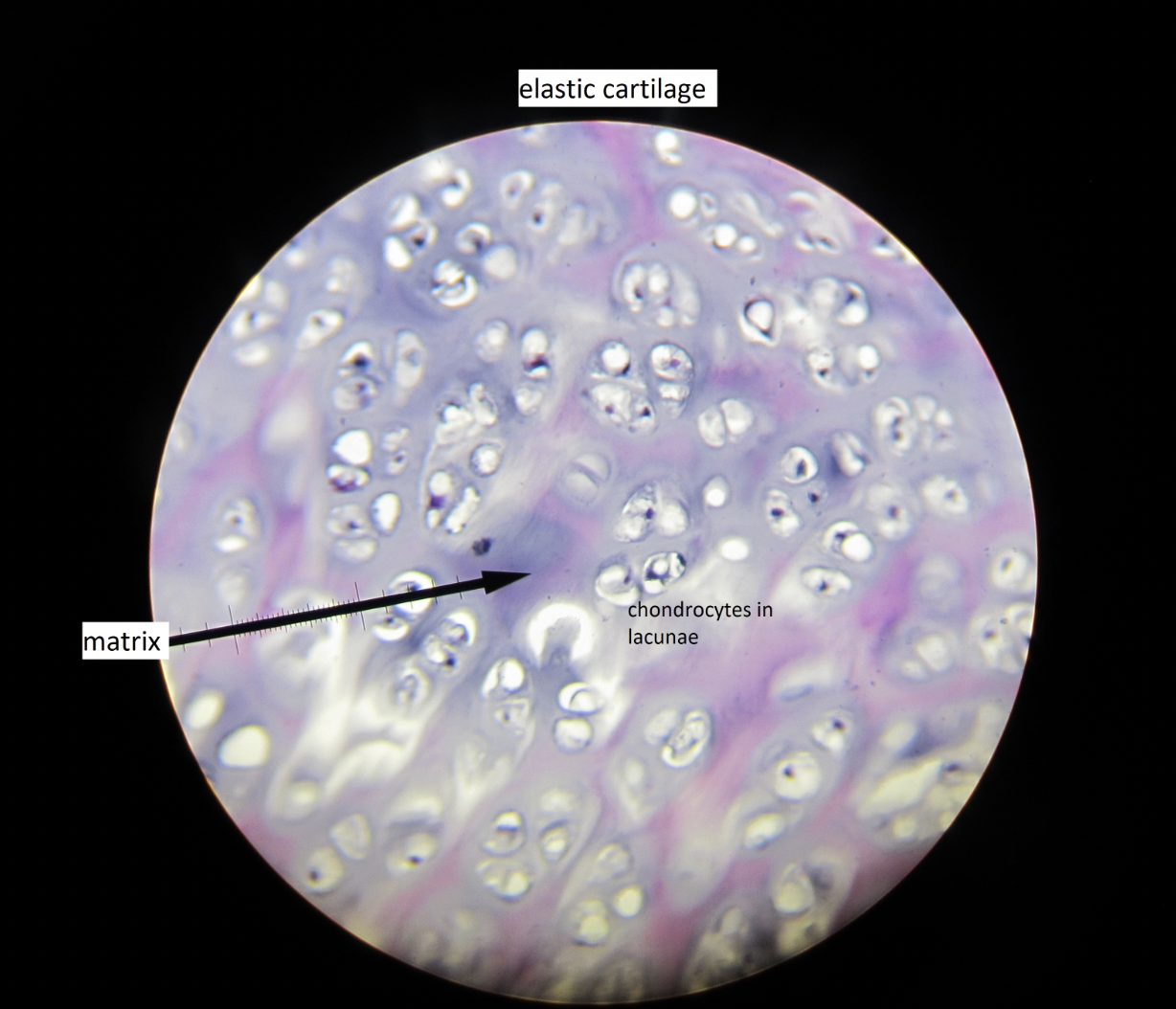 <p>elastic cartilage, flexibility and maintains shape, ex: ear</p>