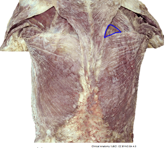 <p>What is the structure outlined in blue called an what is its purpose </p>
