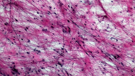 <p>fxn: wraps and cushions organs, found under epithelia</p>