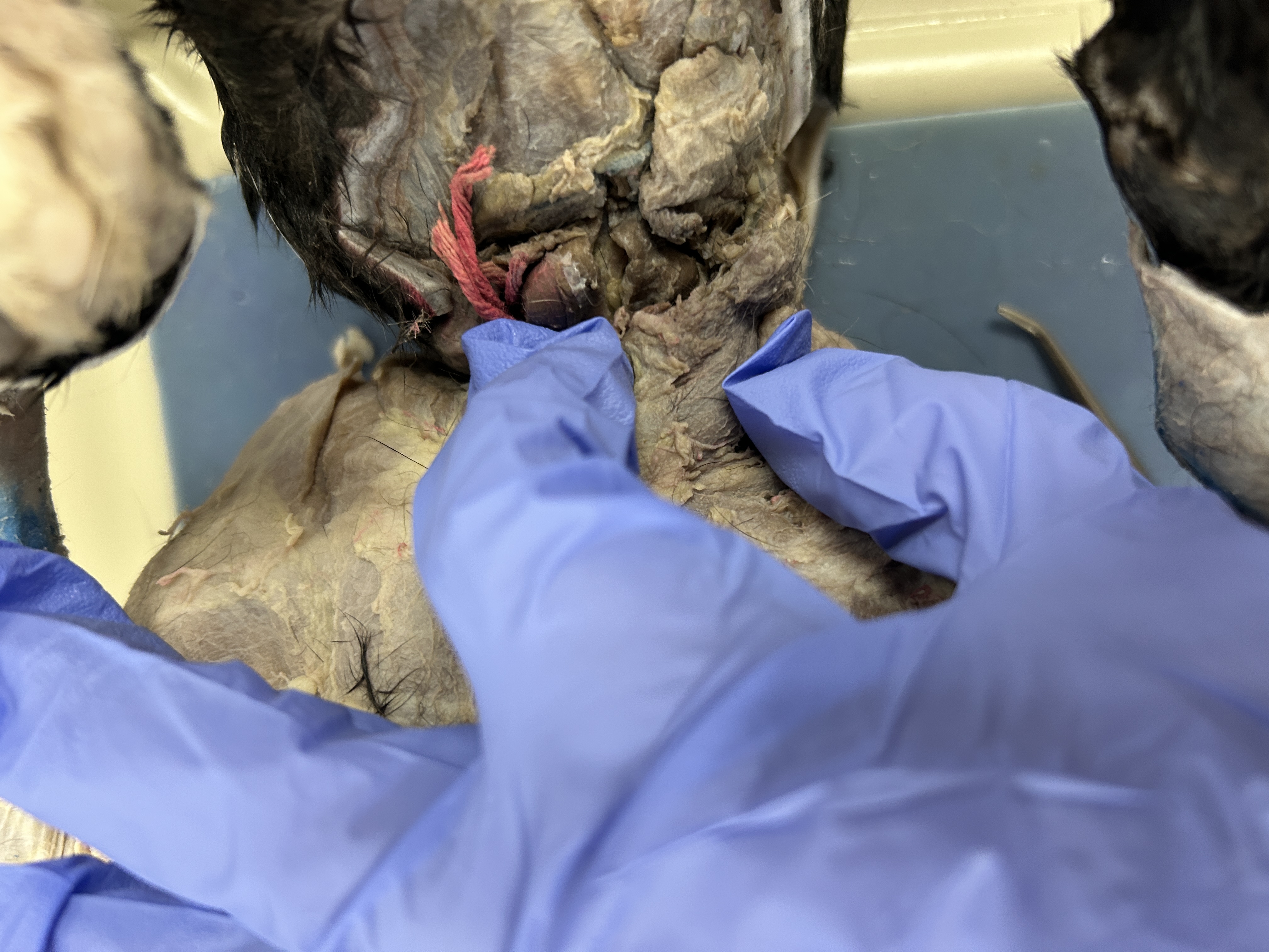 <p>Sternocleidomastoid (lump)</p>