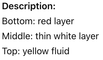 <p>The top layer of a centrifuged blood tube is __________</p>