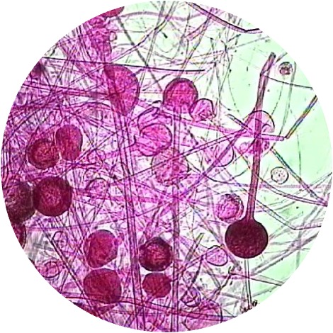 <p>This type of fungi is lollipop shaped and is asexual; reproduce through sporangiospores</p>