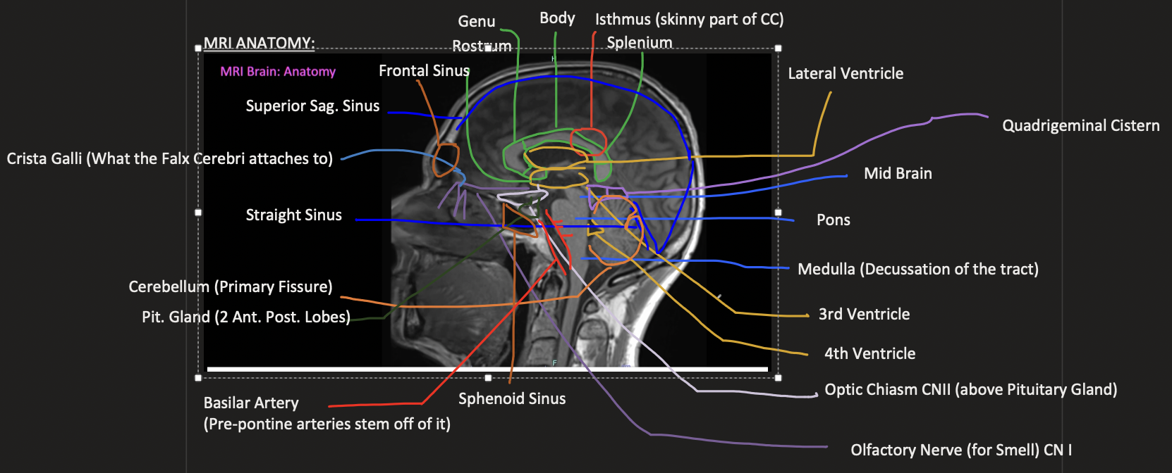 knowt flashcard image