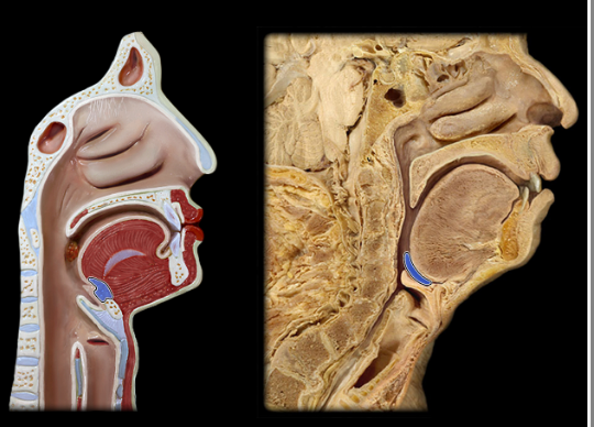 <p><span>Lingual tonsil</span></p>