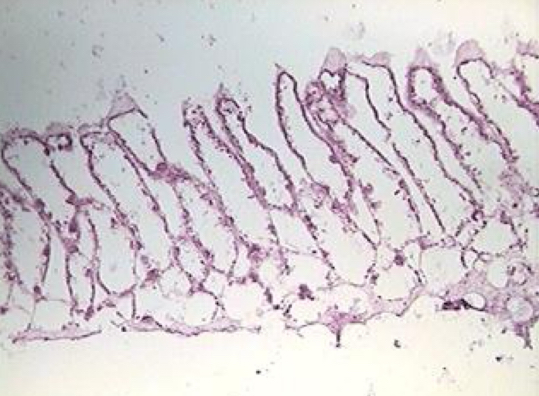 <p>An organism or structure labeled A alongside spicules.</p>
