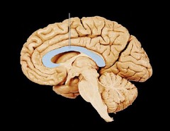 <p>the large band of neural fibers connecting the two brain hemispheres and carrying messages between them.</p>