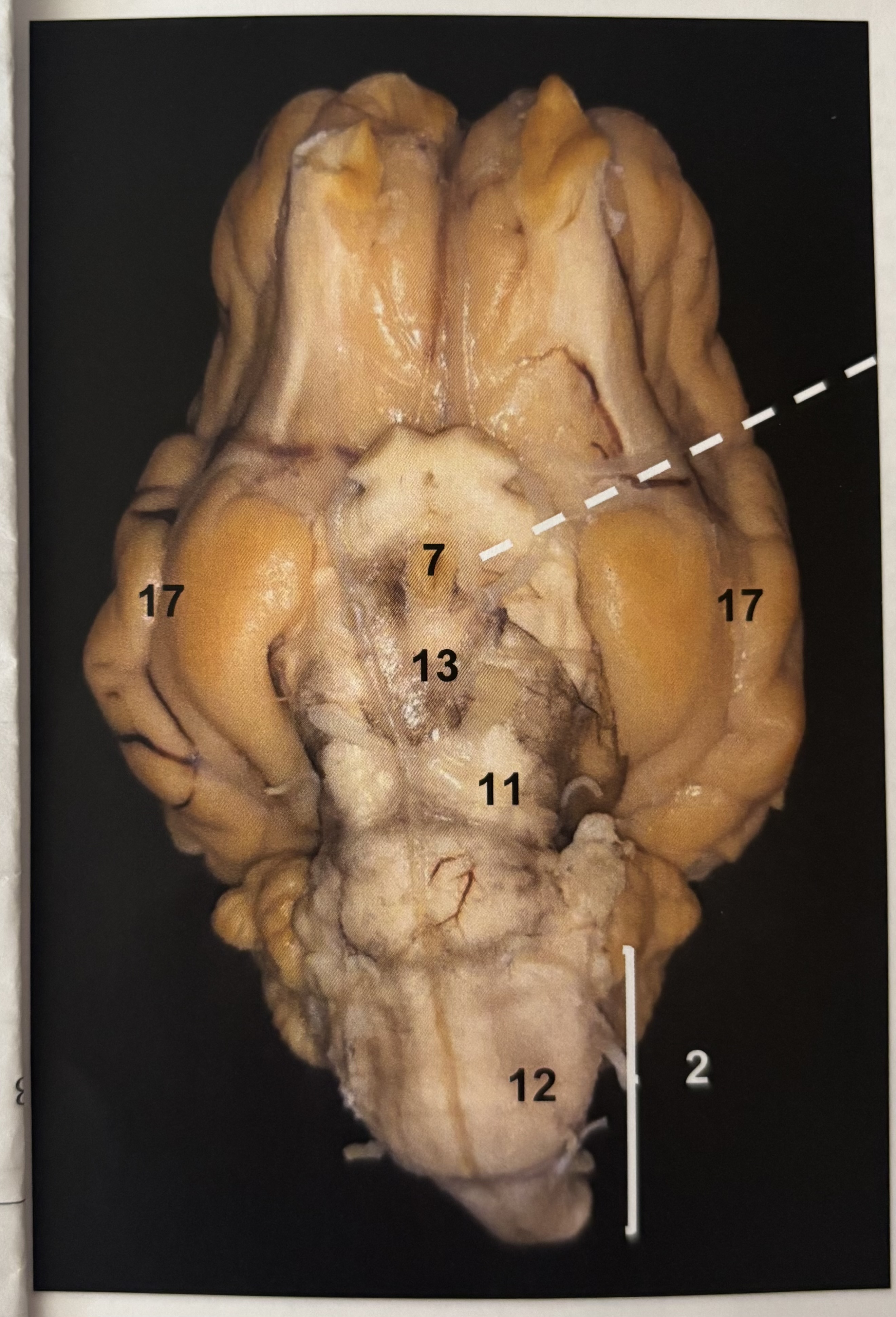 <p>13</p>