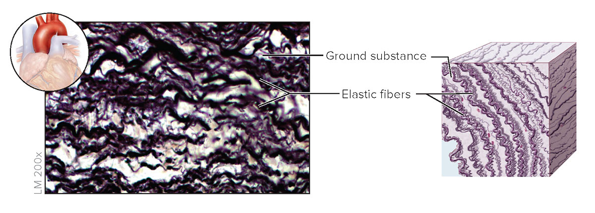<p><strong>Elastic Connective Tissue</strong></p>