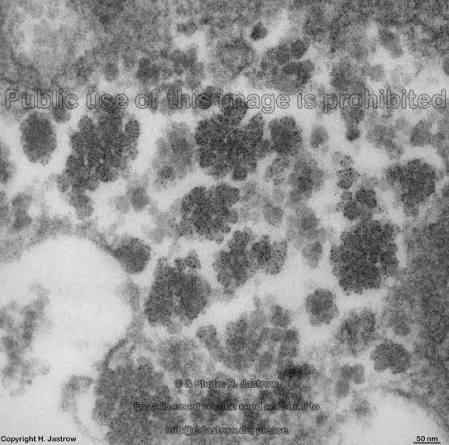<p>Looks like mold on fruit</p>