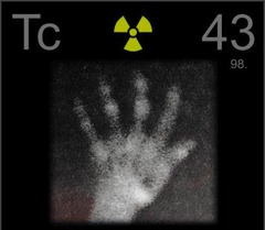 <p>43</p>