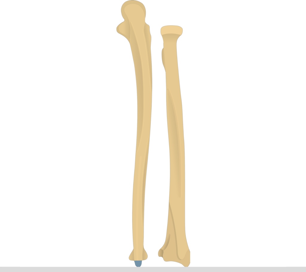 <p>Styloid process of ulna</p>