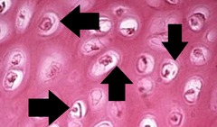 <p>small cavities</p>