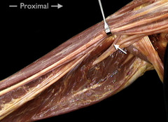 <p>In this anterior view of the right arm, identify the artery indicated by the arrow.</p>
