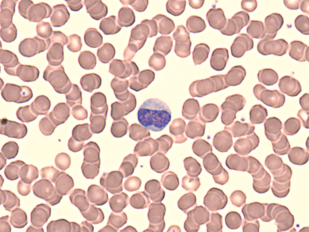 <p>Identify the leukocyte:</p>