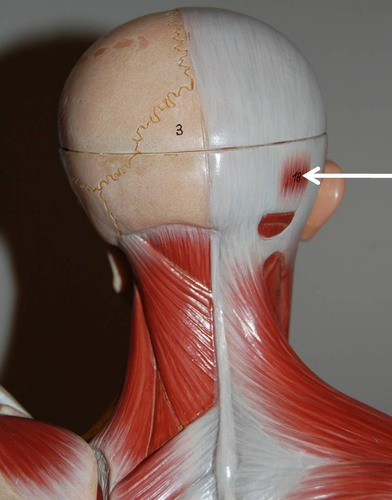 <p>What muscle is this?</p>