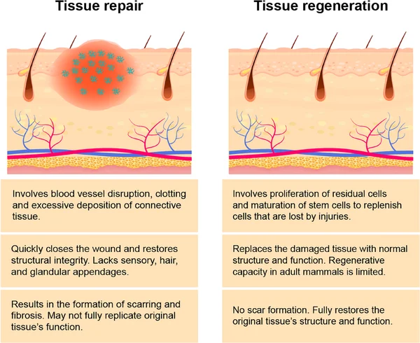 <p>→ Damaged tissue is replaced by regenerated new tissue</p><p>→ Residual defect is filled with fibrous scar tissue</p>