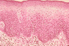 <p>Specific types = Keratinized - contain the protective</p><p>protein keratin; surface cells are dead and full of keratin; Non-keratinized - forms moist lining of body openings</p><p>• Function - Protects underlying tissues in areas subject to</p><p>abrasion</p><p>• Location = Keratinized -</p><p>forms epidermis, Non-keratinized - forms lining of esophagus, mouth, and vagina</p>