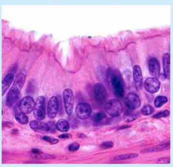 <p>Secretion, movement; lining of the trachea and upper respiratory tract, male reproductive ducts</p>