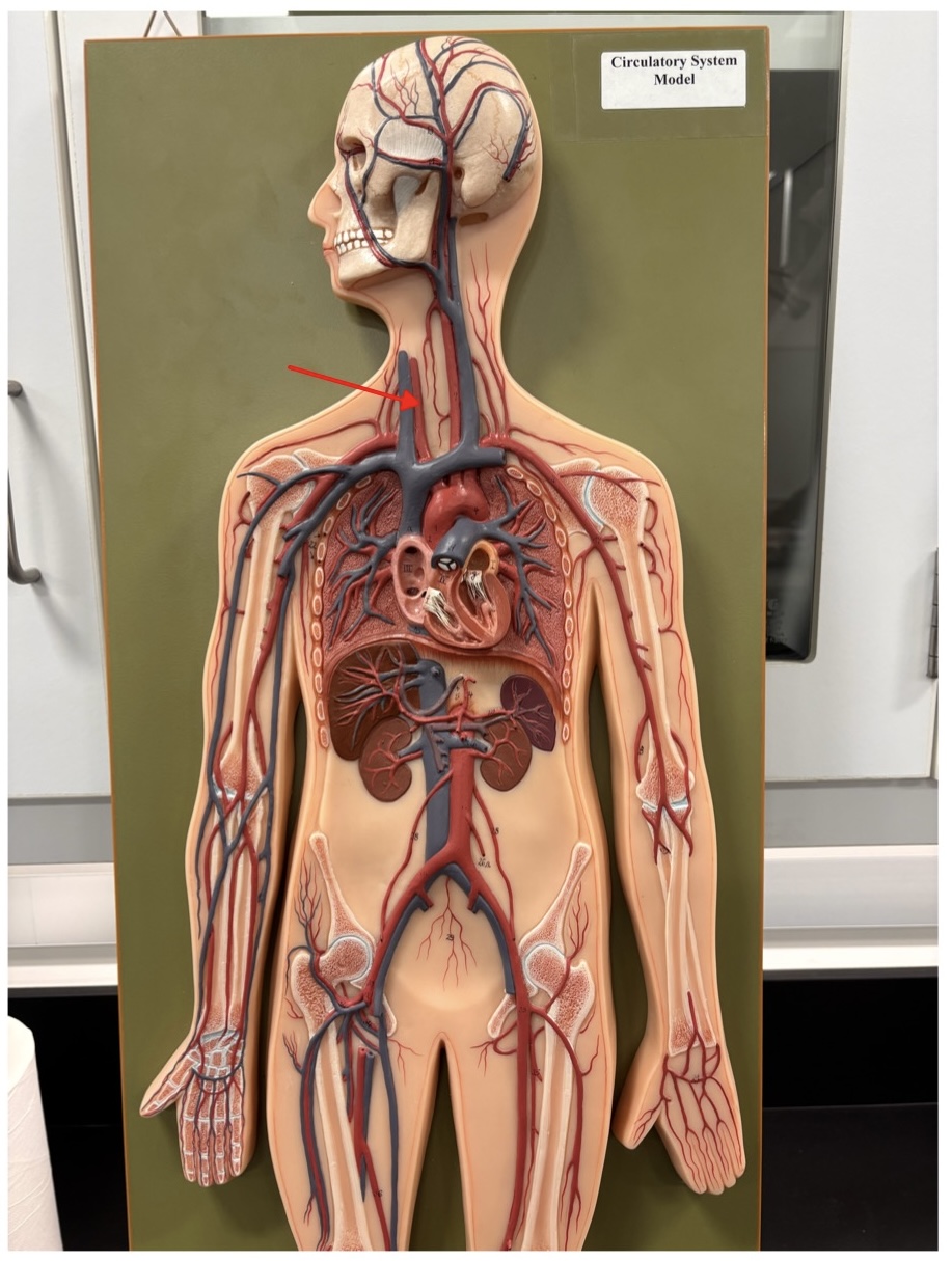 <p>name the blood vessel</p>