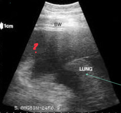 <p>A horse presents with increased respiratory effort, pale mucous membranes, stiff movement, and hypovolemic shock. You see this on ultrasound. Thoughts?</p>