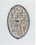 <ul><li><p>egg form of Diphyllobothrium latum </p></li><li><p>causes Diphyllobothriasis<span> (fish tapeworm infection)</span></p></li></ul><p></p>