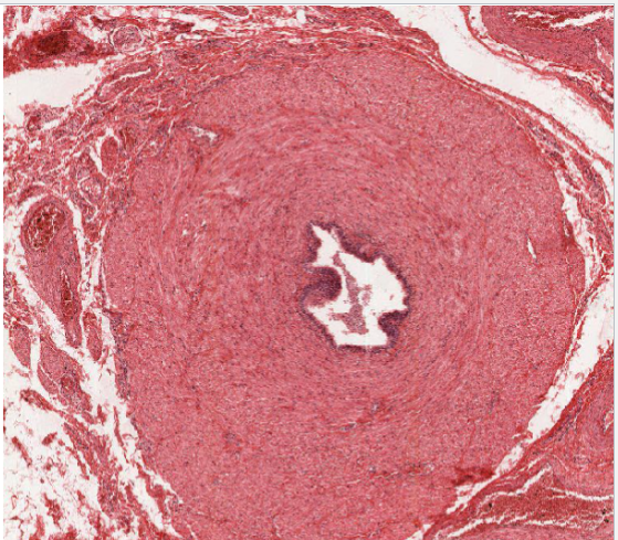 <p>Thin lumen pseudostratified ciliated columnar epithelium</p><p>thick muscle layers bc it needs to work against gravity</p><p></p><p>Function: carry sperm from epididymis</p><p>Lamina propria</p><p>inner longitudinal</p><p>middle circular </p><p></p>