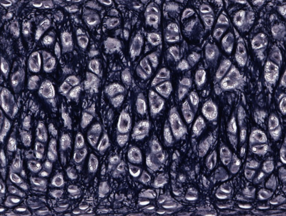 <p>This cartilage has been stained to highlight fibers that make this tissue more flexible. What fibers are there and what type of cartilage is this?</p>