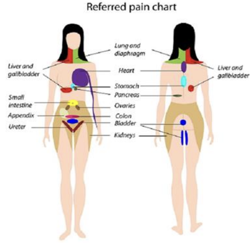 <p><strong>For parietal peritoneum pain, the symptoms tend to be well localized </strong>as the sensory fibers travel directly with the corresponding spinal nerve in each dermatome. </p><p></p><p>In visceral peritoneal pain, the sensory fibers pass through the associated plexus before making their way back to the various spinal cord levels. This means <strong>visceral pain is poorly localized </strong>to the following regions; </p><p>● Foregut pain - experienced in the epigastric region </p><p>● Midgut pain - experienced in the umbilical region </p><p>● Hindgut pain - experienced in the pubic region</p>