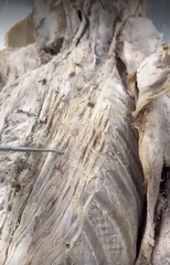 <p>Name the muscle</p><p>- specific area of longissimus</p>