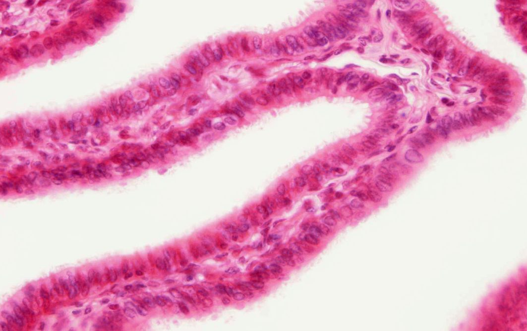 <p>soort epitheel</p>