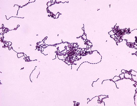<p>S. pyogenes</p>