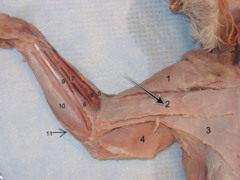 <p>muscle that acts with the superficial muscles of the ventral chest to rotate the forelimb and to draw the forelimb toward the chest</p>
