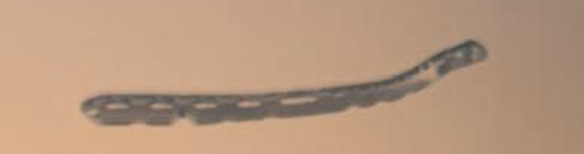 <p>What plate is this </p>