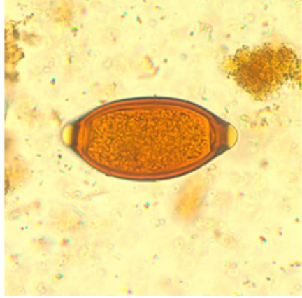 <p>Size: (50-55) X (20-25) - </p><p>Details: 2 Bubble-like (or plug-like) polar prominences / Sorrel Shaped / Thick Wall</p>
