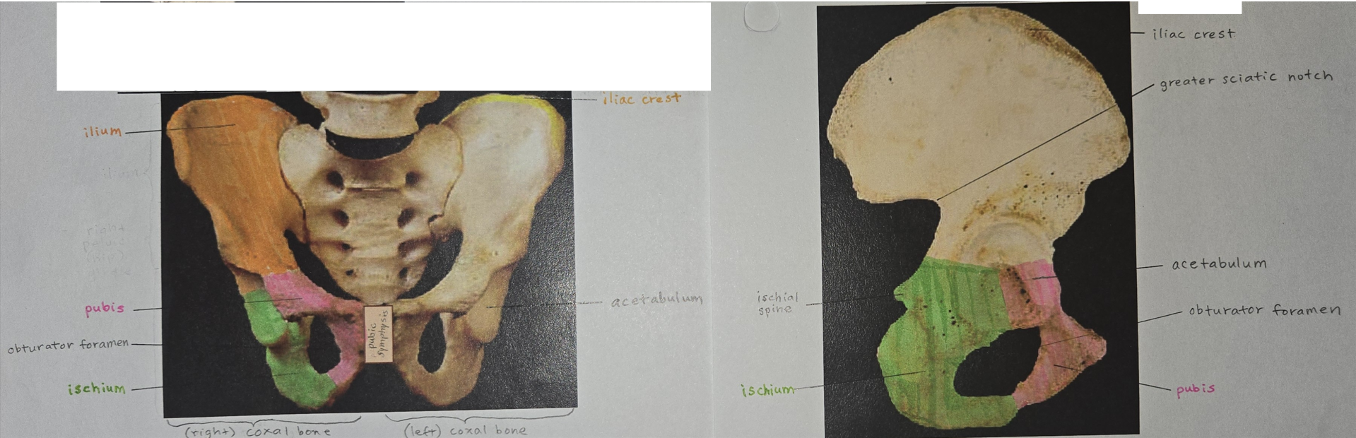 <p>pubic symphysis, ilium, ischium, pubis, acetabulum, iliac crest, ischial spine, greater sciatic notch, obturator foramen</p>