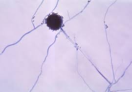 <p>Aspergillus (Asomycota)</p>