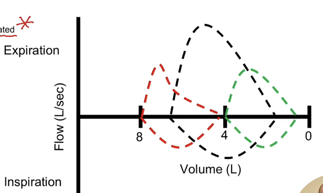 <p>Black is normal</p><p>Red is obstructive</p><p>Green is restrictive </p>