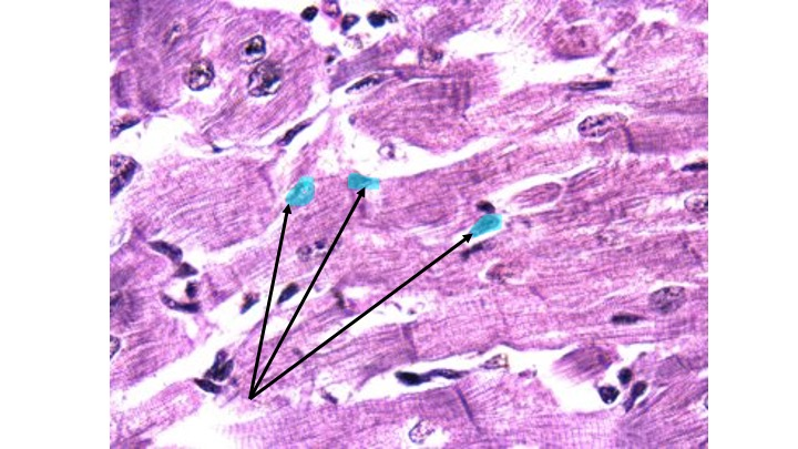 <p>Identify the type of muscle tissue.</p>