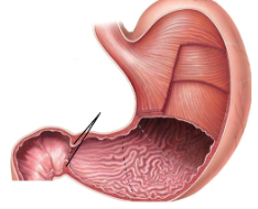 <p><span style="line-height: 17.375px;">Identify the sphincter&nbsp;</span></p>