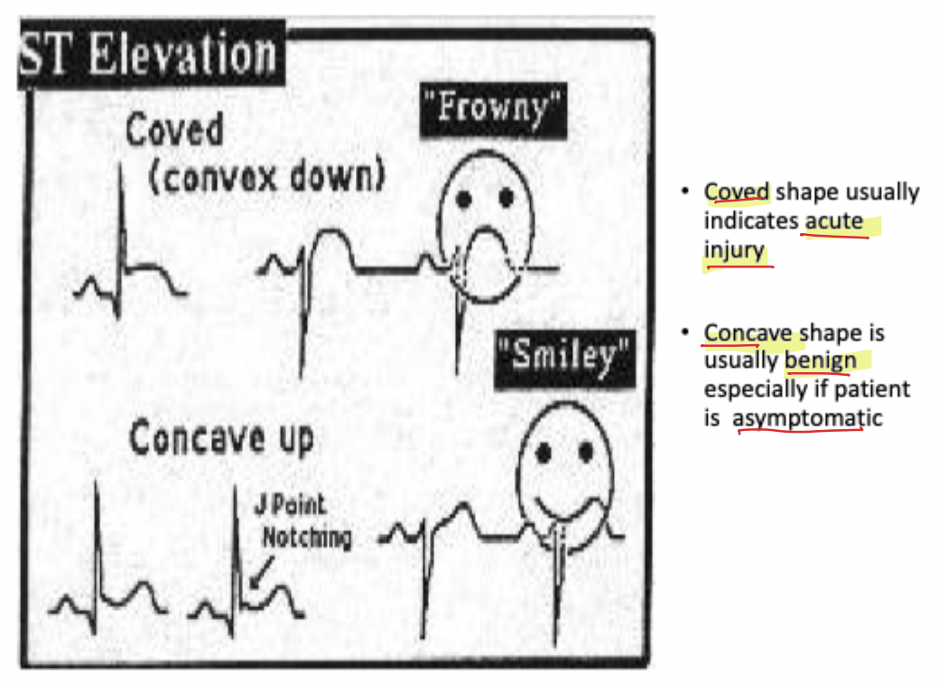 <p><strong>Acute injury</strong></p>