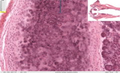 <p>tissue</p>