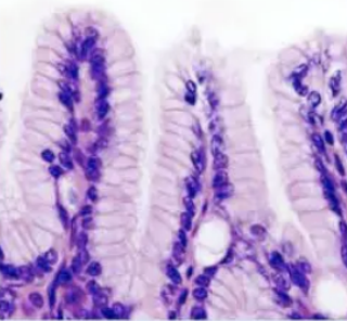 <p><strong>simple columnar</strong>: location</p>