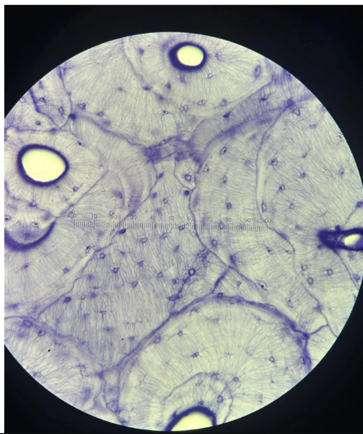<p><span style="background-color: transparent;">human<strong> </strong>bone and decalcified</span></p>