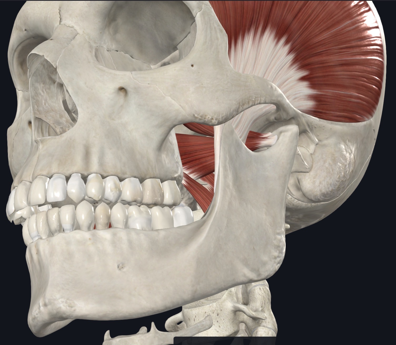 <p>Bilateral: Protrusion of jaw opening</p><p>Unilateral: Protrusion to opposite side; stabilizes condylar head against articular eminence during closure</p>