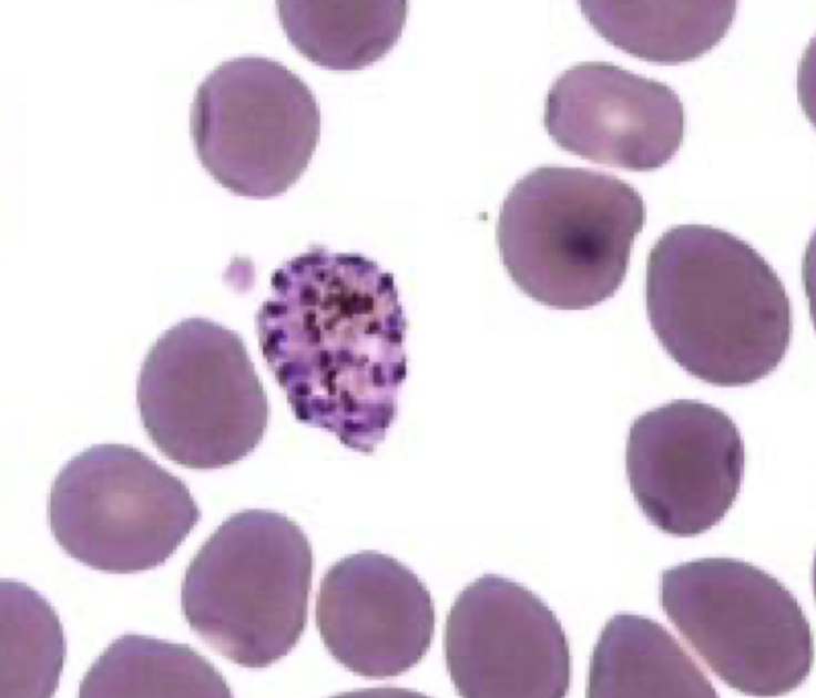 <p>What parasite is this?</p>